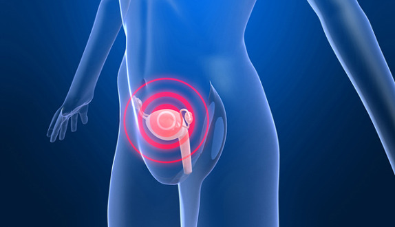 How will my doctor know if I have ovarian cancer?