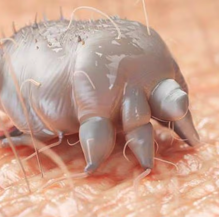 Understanding Scabies - The Itchy Intruders on Your Skin