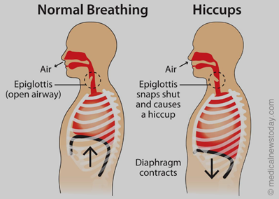 Discover the Temple Method: A Quick Fix for Hiccups!
