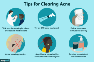 Finding Your Path to Clear Skin: The Best Way to Treat Acne