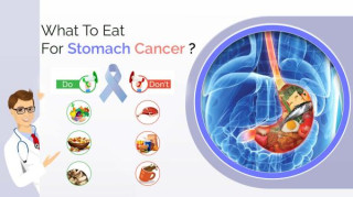 The Link Between Diet and Stomach Cancer