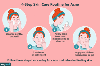 Managing Acne Breakouts: Treating All Acne-Prone Areas