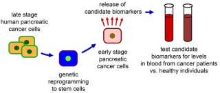 Decoding the Diagnosis: How Doctors Detect Pancreatic Cancer