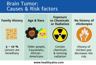 Unraveling the Enigma: Exploring the Causes of Brain Tumors