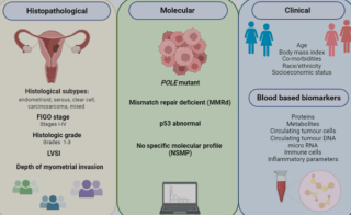 What's new in endometrial cancer research and treatment?