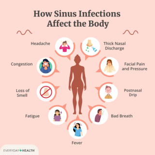 Exploring Antibiotics for Sinus Infections: Understanding Treatment Options