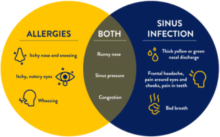 Exploring the Controversial Link Between Food Allergies and Sinusitis