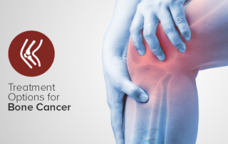 Exploring Treatment Options for Bone Cancer: A Comprehensive Guide