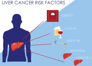 Understanding the Link: Cirrhosis and Liver Cancer Risk