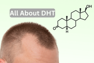 Understanding DHT: The Culprit Behind Acne Breakouts