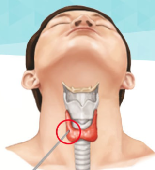 How do you diagnose thyroid cancer?