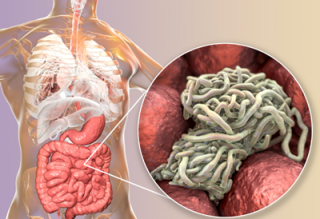 Banishing Pinworms - A Guide to Treatment and Recovery