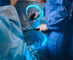 Surgery for Colorectal Cancer