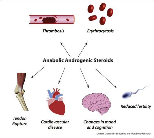 Unveiling the Link: Anabolic Steroids and Liver Cancer Risk