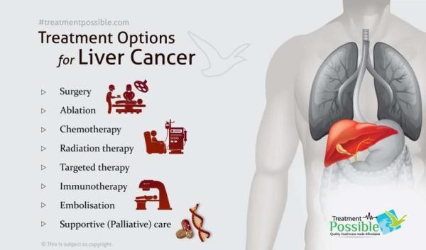 Treatment for Liver Cancer? What should I ask?