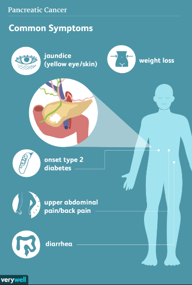 Unveiling the Elusive Symptoms of Pancreatic Cancer