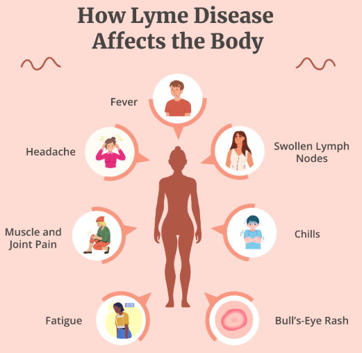 What is Lyme Disease?