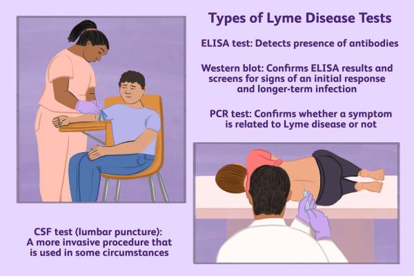 A test for Lyme disease