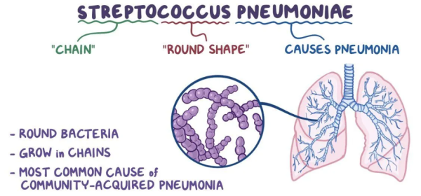 Can you do a culture to find out what bacteria are causing sinus infection?