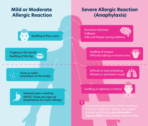 A Parent's Quick Guide: Responding to Severe Allergic Reactions in Babies