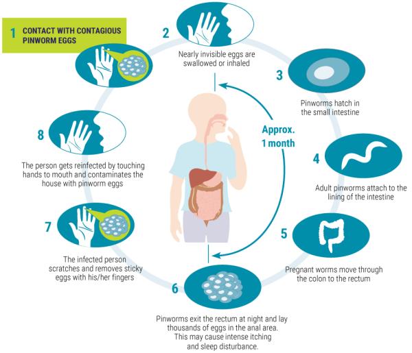 Demystifying Pinworms - A Common Nuisance in Childhood