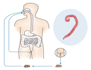 Pinworm Prevention: A Proactive Approach for Parents